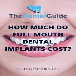 Full Mouth Dental Implants - The Dental Guide